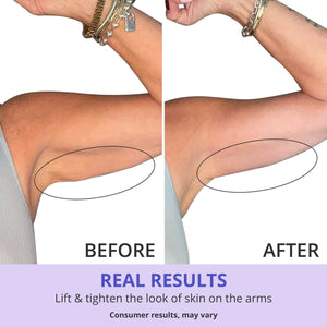 Tight Arm Cream